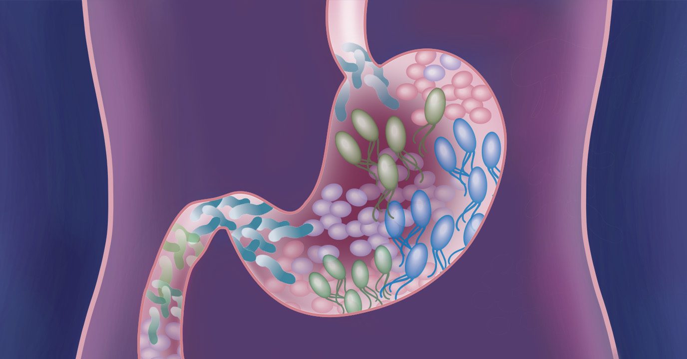 stomach showing bacteria and digestive problem